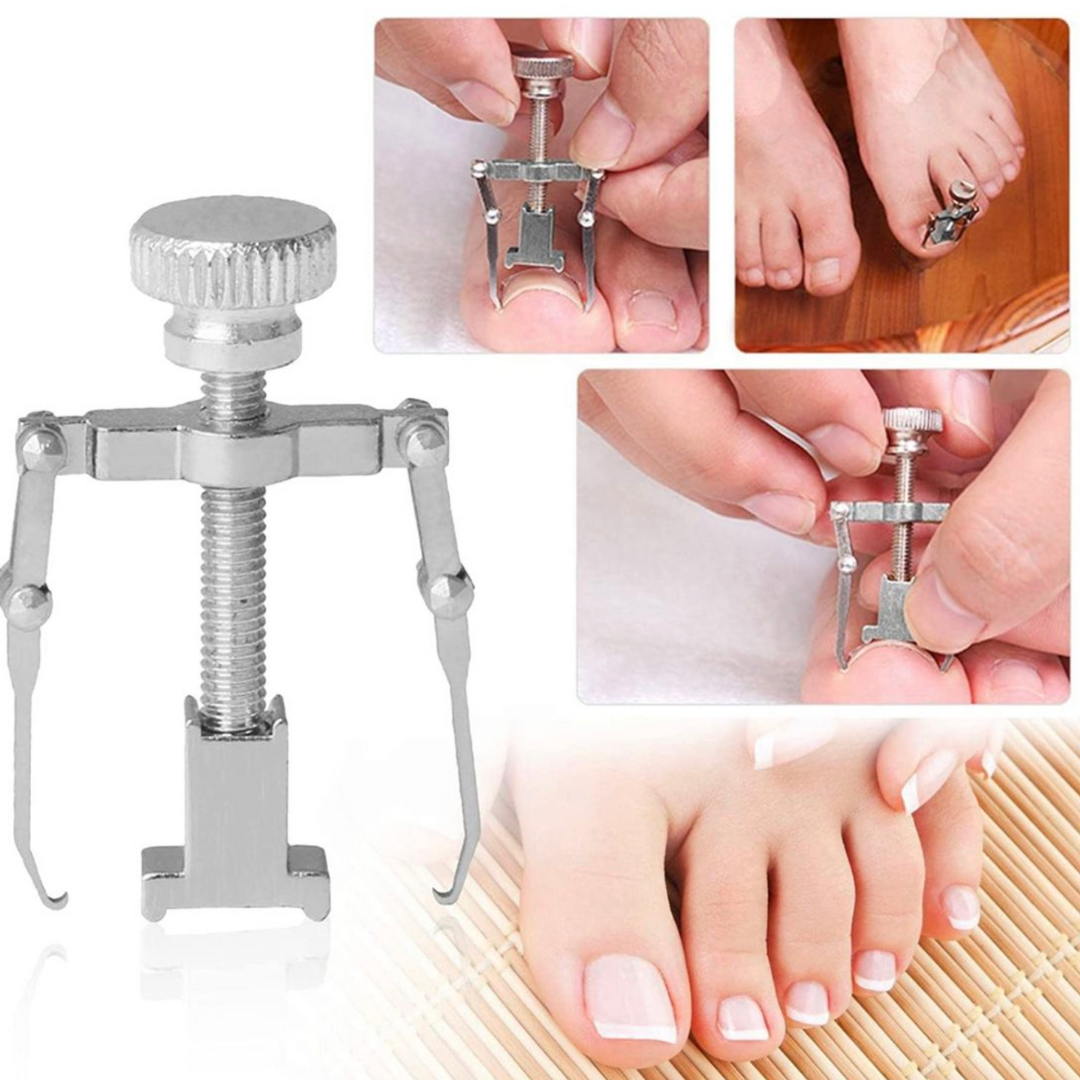 Corector unghii incarnate IngroStop™