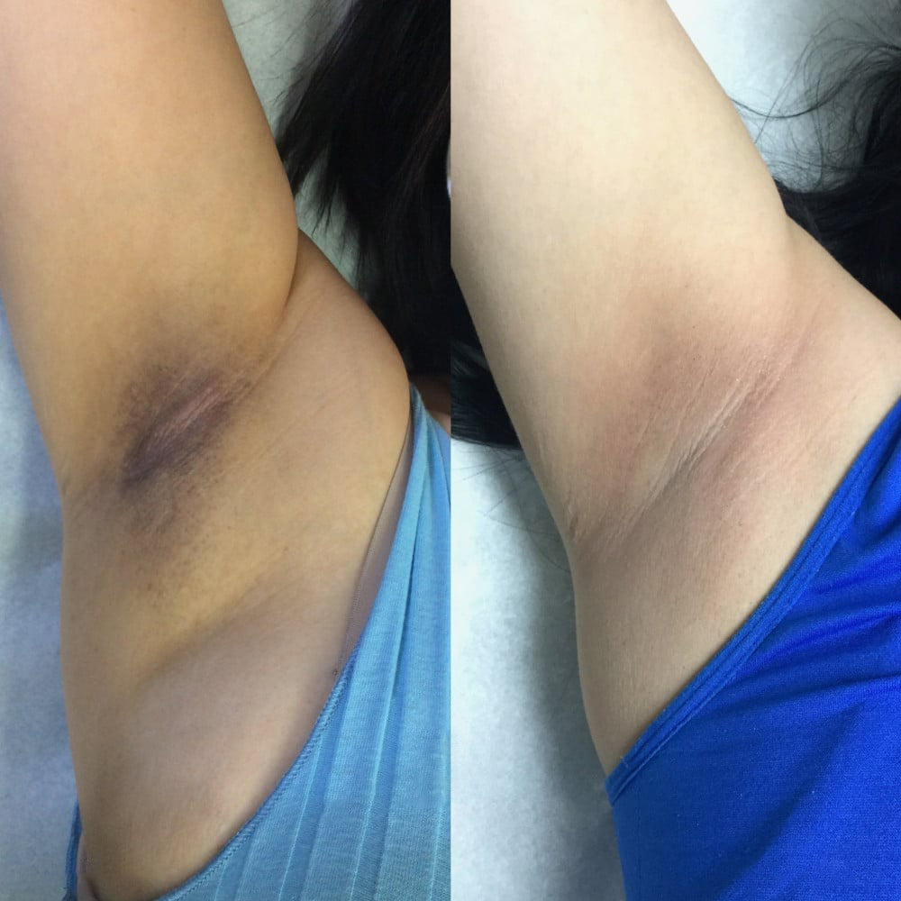 Cremă tip stick "Fără pete întunecate"