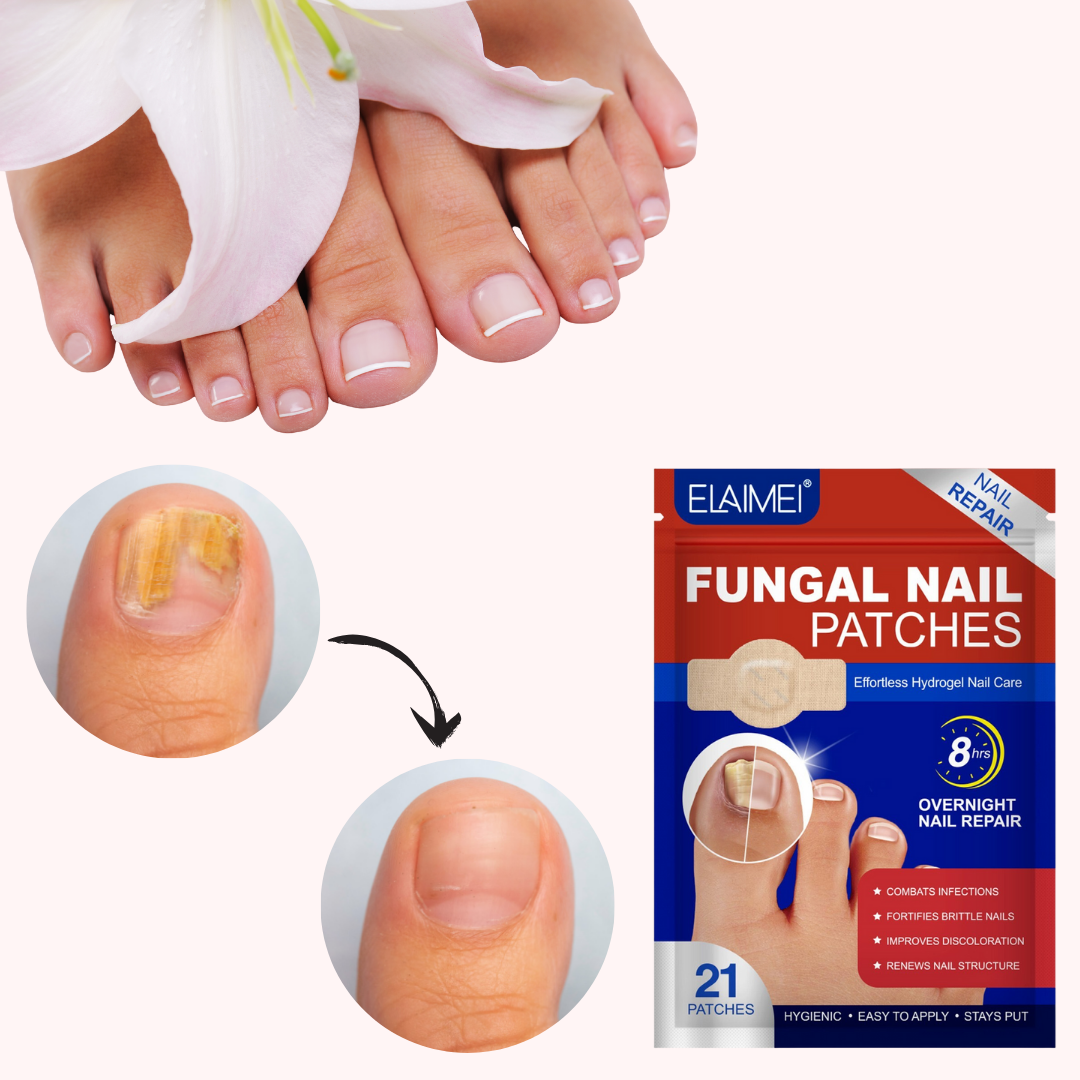 Plasturi pentru tratamentul unghiilor MycoStop