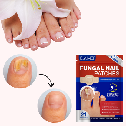 Plasturi pentru tratamentul unghiilor MycoStop