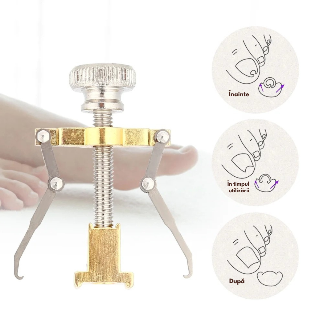 Corector unghii incarnate IngroStop™