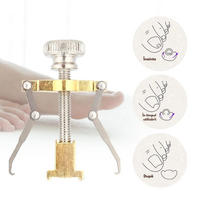 Corector unghii incarnate IngroStop™