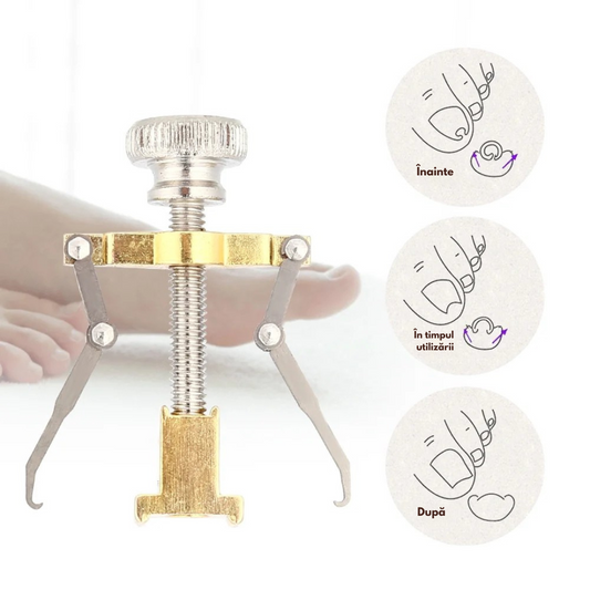 Corector unghii incarnate IngroStop™