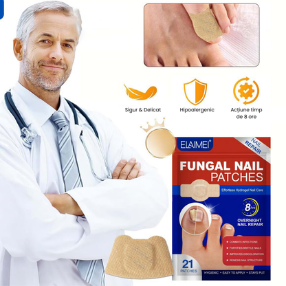 Plasturi pentru tratamentul unghiilor MycoStop