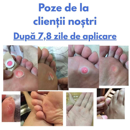 Plasturi adezivi pentru bataturi si calusuri CornPads™