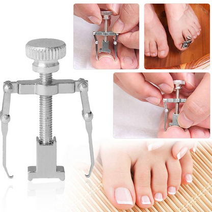 Corector unghii incarnate IngroStop™