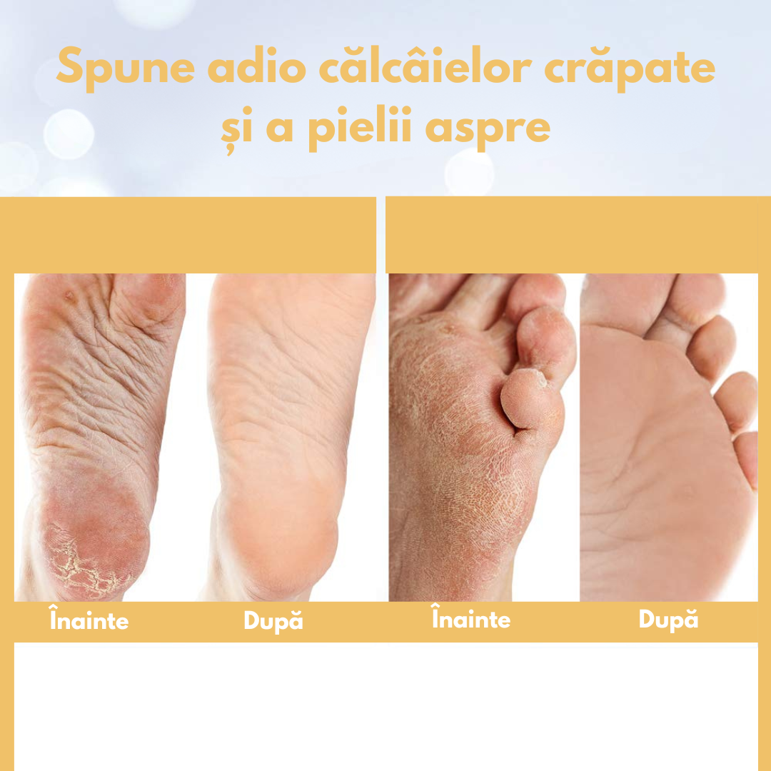 Spray Peeling Picioare PeelOff