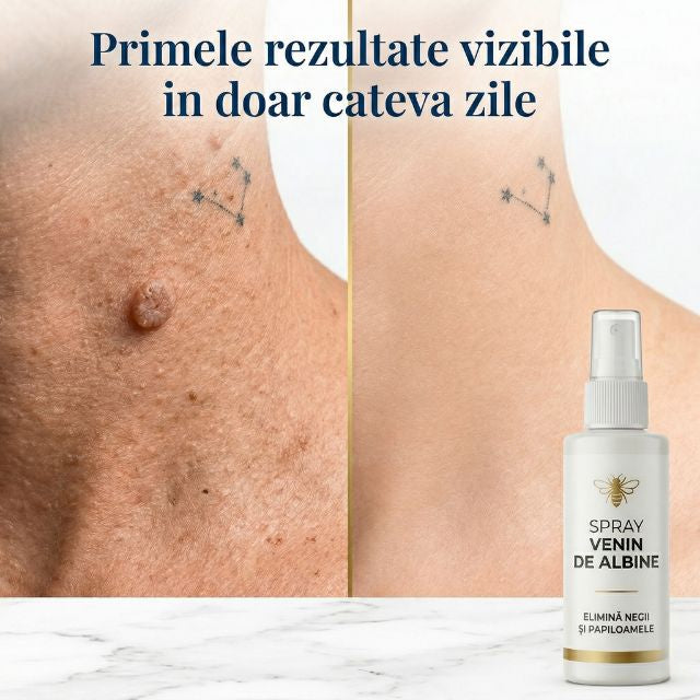 Spray cu venin de albine