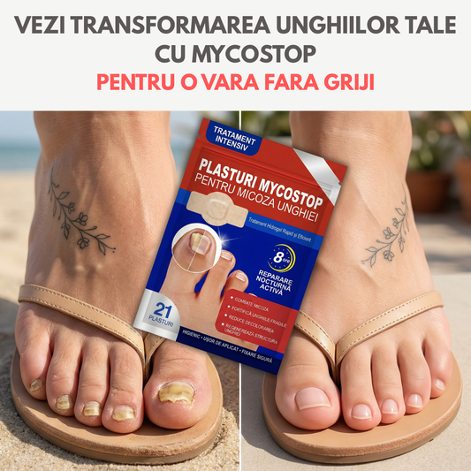 Plasturi pentru tratamentul unghiilor MycoStop